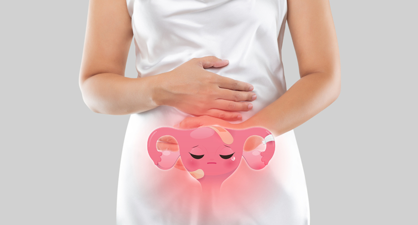 Diagnosis and Surgical Treatment of Endometriosis