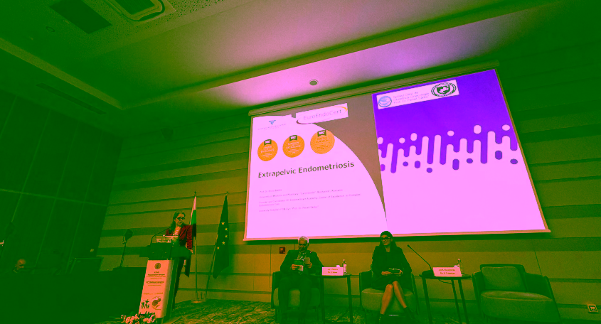 Extrapelvic Endometriosis Extrapelvic Endometriosis